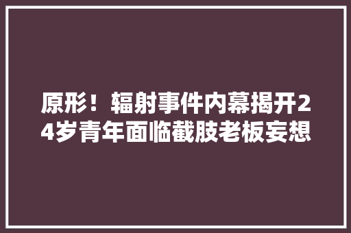原形！辐射事件内幕揭开24岁青年面临截肢老板妄想扼杀正义！