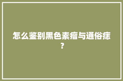 怎么鉴别黑色素瘤与通俗痣？