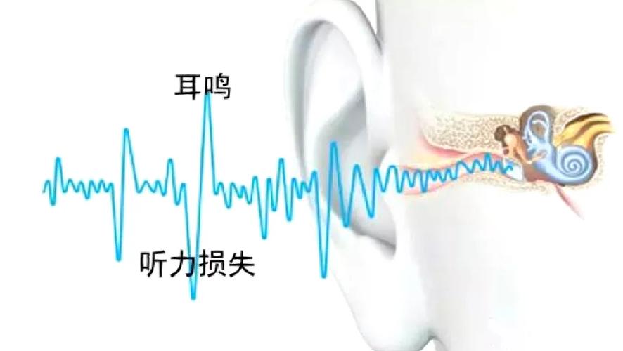 新研究警告:电子游戏与耳鸣和听力损失加剧有关 智能科技 新研究警告:电子游戏与耳鸣和听力损失加剧有关 新研究警告:电子游戏与耳鸣和听力损失加剧有关 智能科技