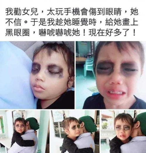 假期贪恋电子产品伤眼睛 智能家居 假期贪恋电子产品伤眼睛 假期贪恋电子产品伤眼睛 智能家居