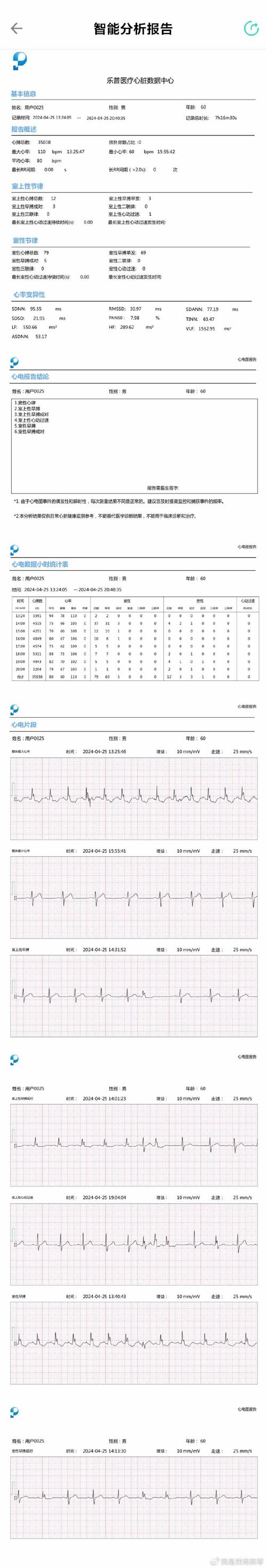 被失落眠困扰/ST段抬高的中年人乐普心电仪比拟实测(ER1-ER2S) 智能家居 被失落眠困扰/ST段抬高的中年人乐普心电仪比拟实测(ER1-ER2S) 被失落眠困扰/ST段抬高的中年人乐普心电仪比拟实测(ER1-ER2S) 智能家居