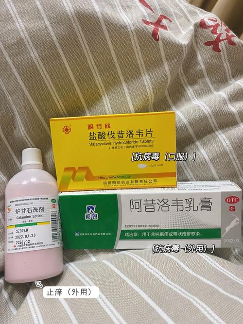 得了水痘需要治疗和吃药吗? 智能家居 得了水痘需要治疗和吃药吗? 得了水痘需要治疗和吃药吗? 智能家居