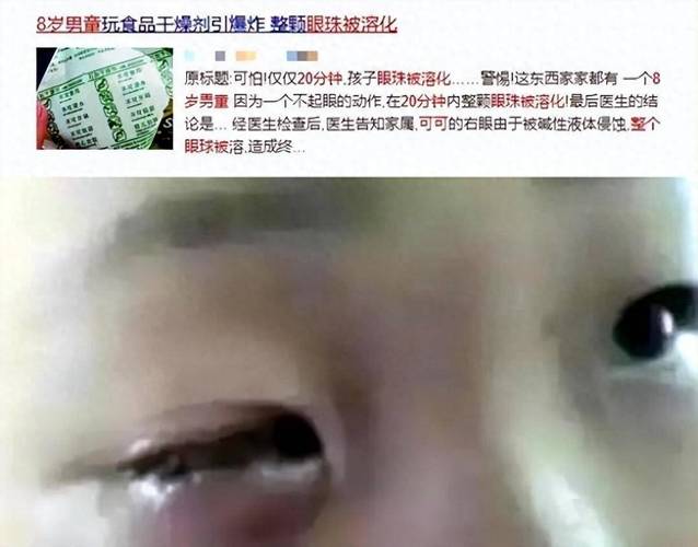 短短20分钟!8岁男孩全体眼球被消融终生失落明 智能科技 短短20分钟!8岁男孩全体眼球被消融终生失落明 短短20分钟!8岁男孩全体眼球被消融终生失落明 智能科技