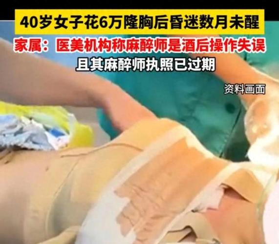 女子隆胸手术无码视频被偷发到网上病院:涉事者已离职 智能科技 女子隆胸手术无码视频被偷发到网上病院:涉事者已离职 女子隆胸手术无码视频被偷发到网上病院:涉事者已离职 智能科技