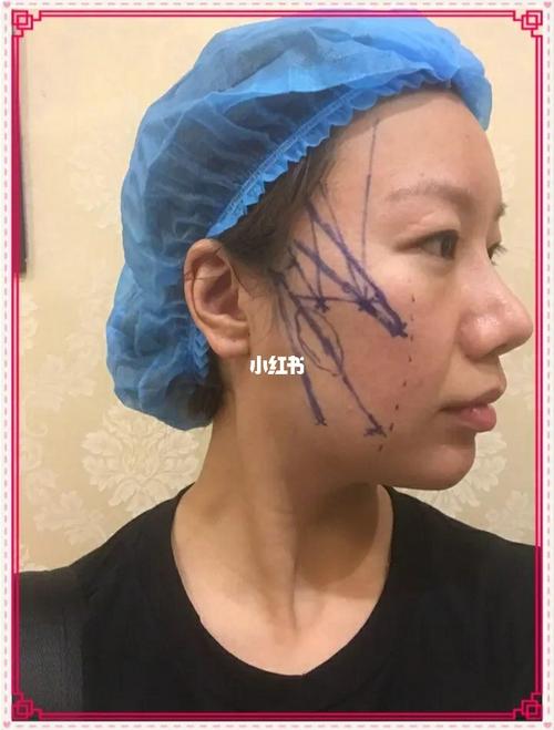 一套全自动的拉皮套分娩线每小时产量能做到一百五十公斤 一套全自动的拉皮套分娩线每小时产量能做到一百五十公斤 智能家居